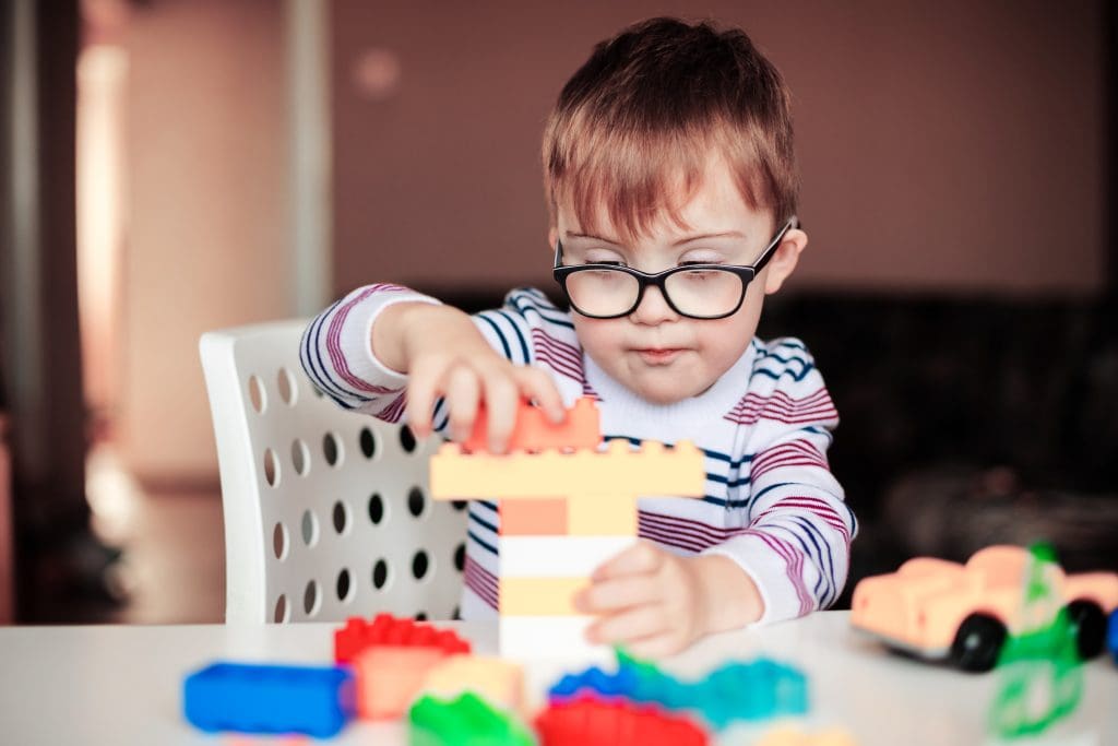 Little boy with special needs playing with legos